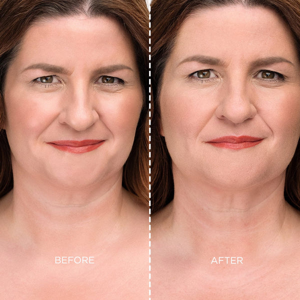 A side-by-side comparison of a woman’s face labelled “Before” and “After.” In the “Before” image, her complexion appears slightly shinier with more visible fine lines. In the “After” image, her skin looks more matte and smooth, with softened lines and a more even finish. A vertical dashed line separates the two photos.